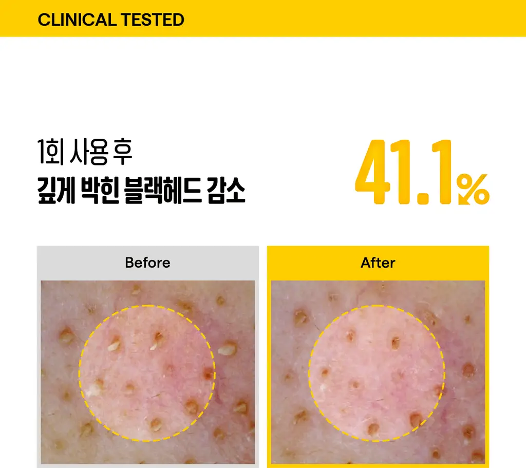 [포켓몬에디션/마이크로버블] 마녀공장 퓨어 소이빈 클렌징폼 120ml 2입 기획 (+스티커) 상세페이지 15